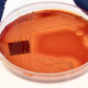 Illustration for article titled It's Time to Kick Big Pharma Out of Antibiotics Research, Scientists Argue